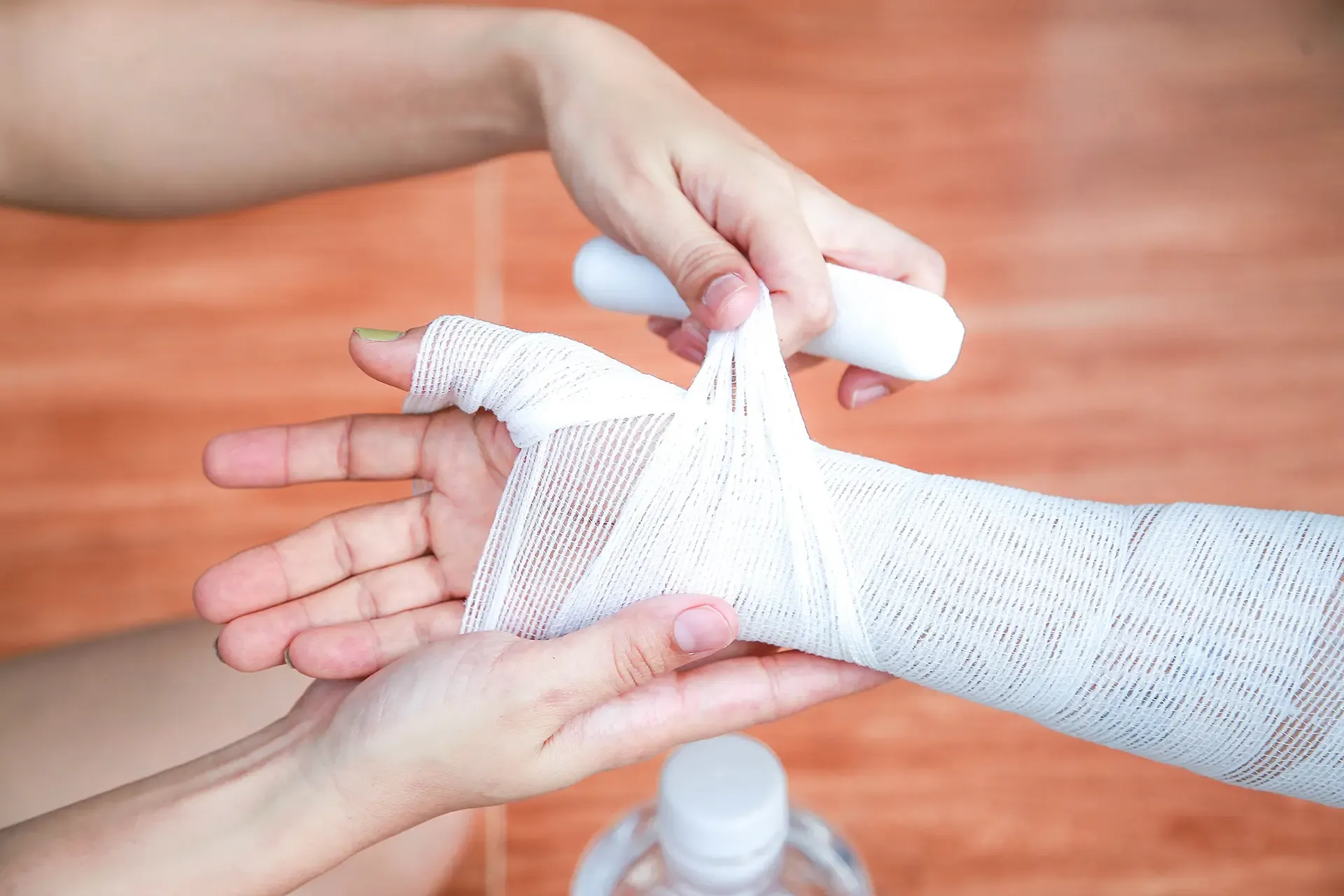 Fighting For Burn Injury Compensation