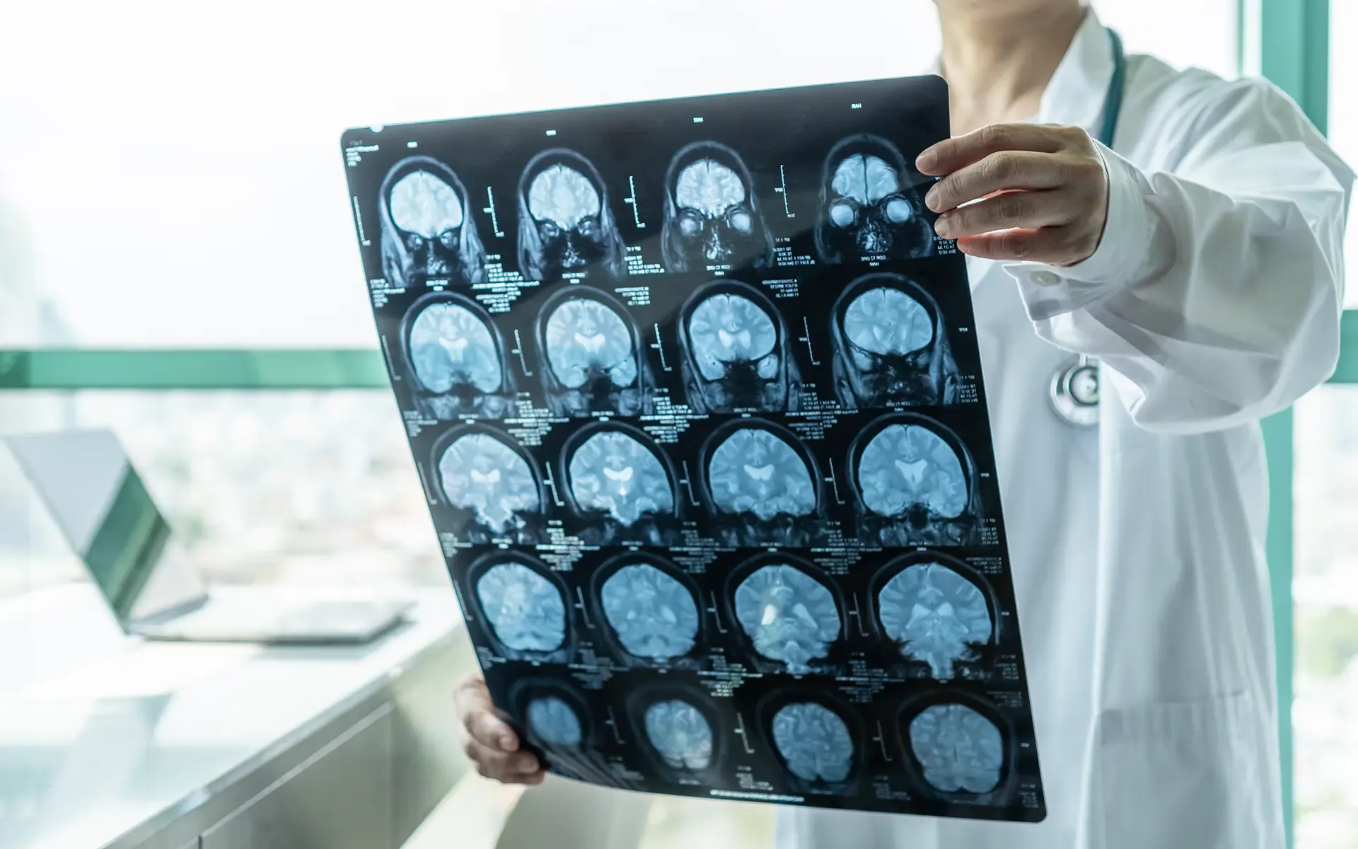 How Much Compensation May I Be Entitled To After A Traumatic Brain Injury How Much Compensation May I Be Entitled To After A Traumatic Brain Injury