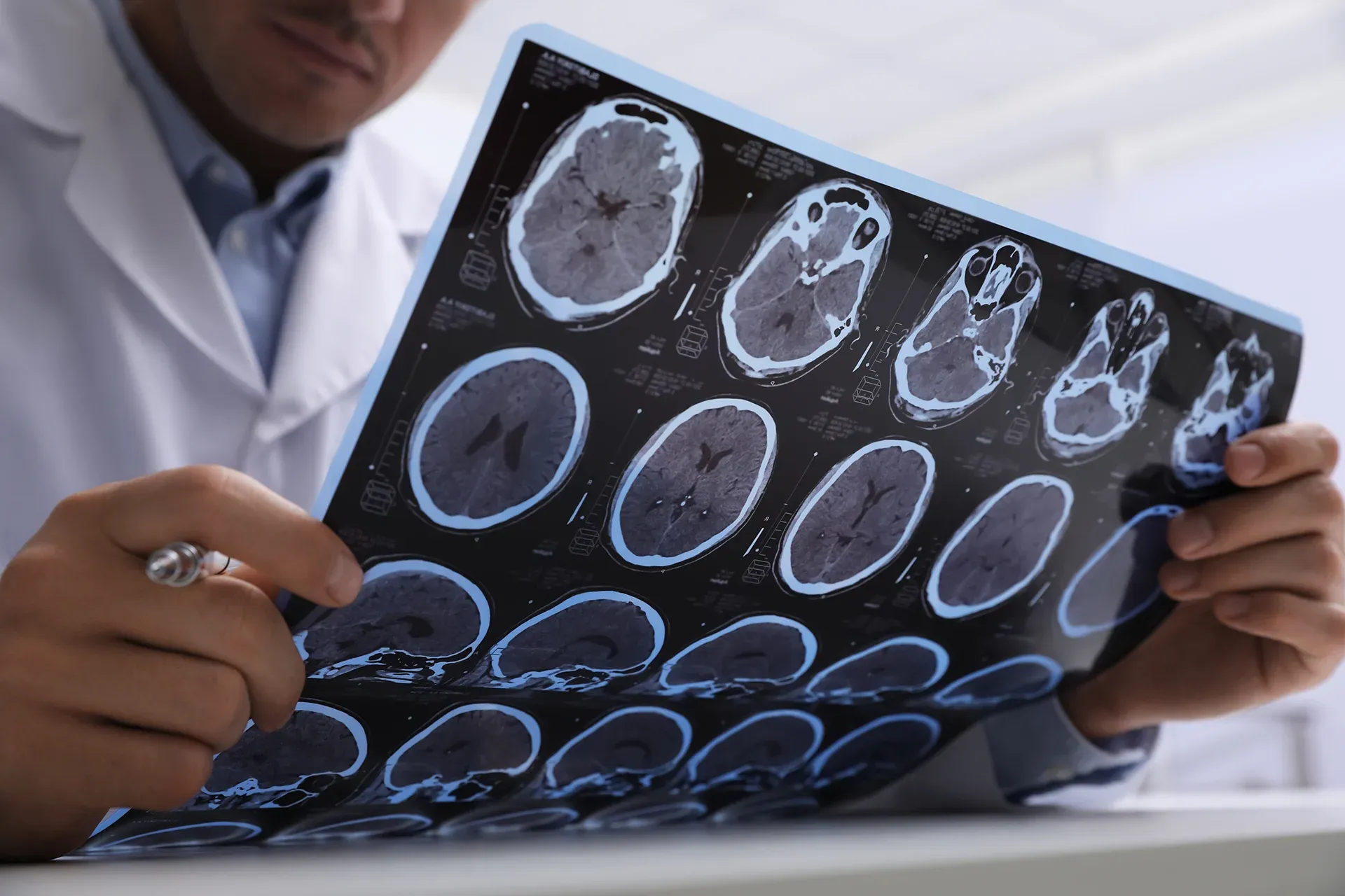 Possible Effects Of A Concussion From A Car Accident Possible Effects Of A Concussion From A Car Accident