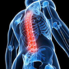 Chicago spinal cord injury attorney, spinal cord injuries, spinal cord injury, Chicago car accident attorneys, physical therapy, traumatic injur