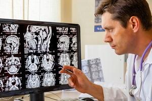 Chicago brain injury lawyer